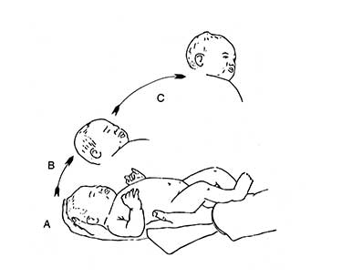 Anterior fontanelle pressure change monitoring